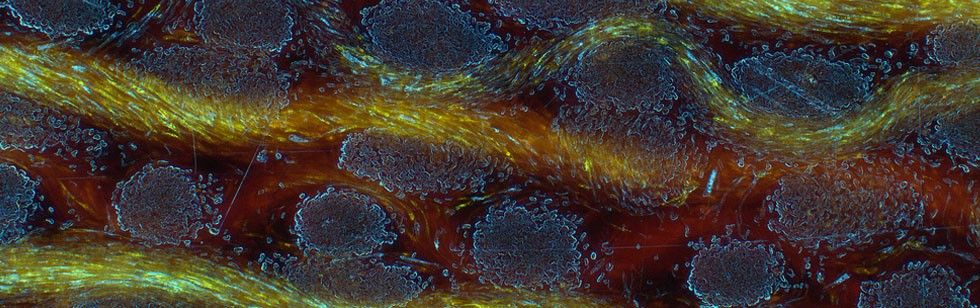 Köhler Illumination